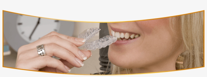 Clear Braces San Luis Obispo Ca - Clear Aligners, transparent png