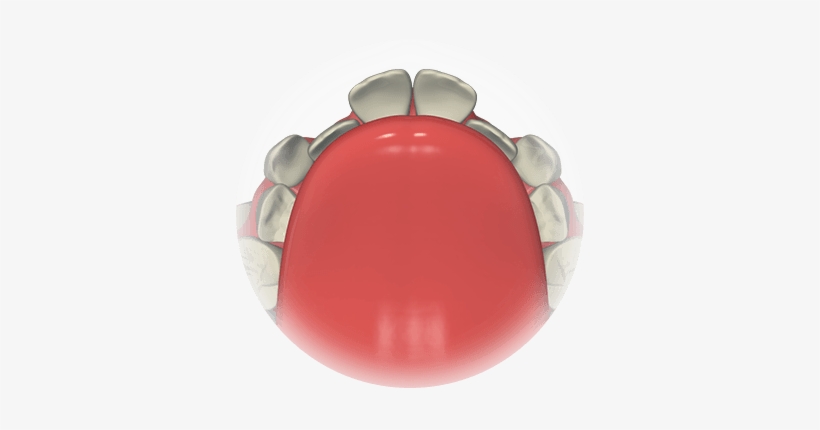 Modern Research Has Shown That Crowded Teeth, Incorrect - Orthodontics, transparent png