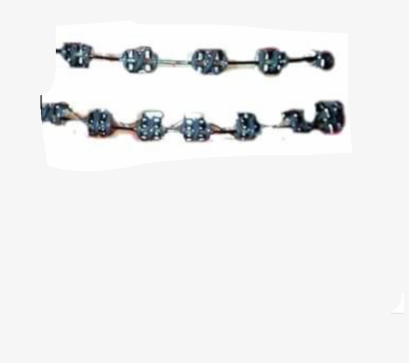 Png Tumblr Pngtumblr Pngs Brackets Smile Freetoedit - Brackets Png, transparent png