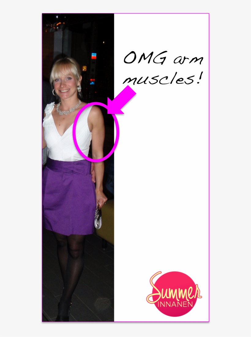 Beforeafter2 - Women Deltoid Before And After, transparent png