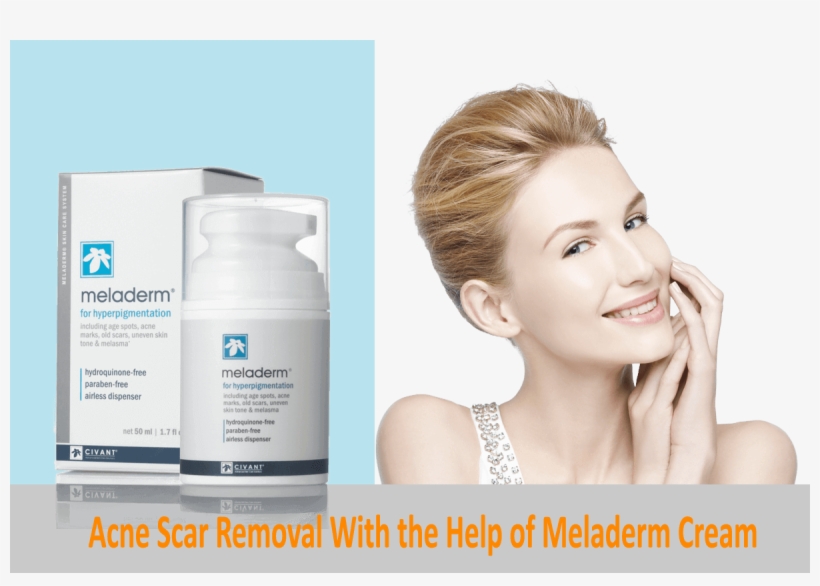 Acne Scar Removal With The Help Of Meladerm Cream Topskinlighteningcreams - Meladerm Cream, transparent png