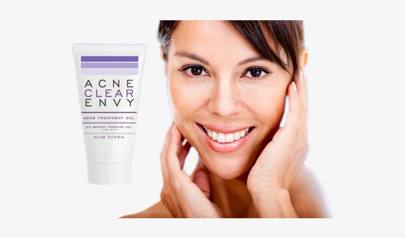 Acne, transparent png