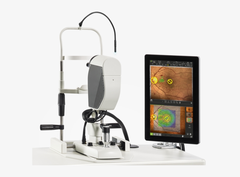 Navilas 577s Navigated Retina Laser - Od Os Navilas, transparent png