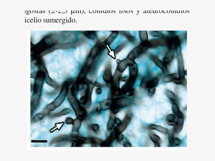 Staining, transparent png