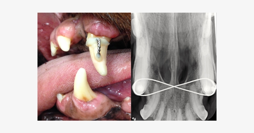 Left To Right - Human Tooth, transparent png
