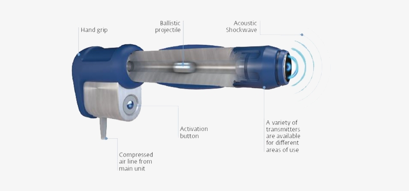 Is Broken As A Result Of Shock Wave Therapy And The - Does Shock Wave Therapy Work, transparent png