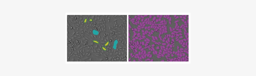 Cho Cells In These Images Were Plated At 4000 Cells - Graphic Design, transparent png