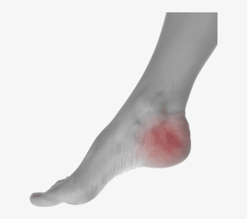 Choose The Most Trusted Podiatrist Doctor In The Area - Pain In Foot Png, transparent png