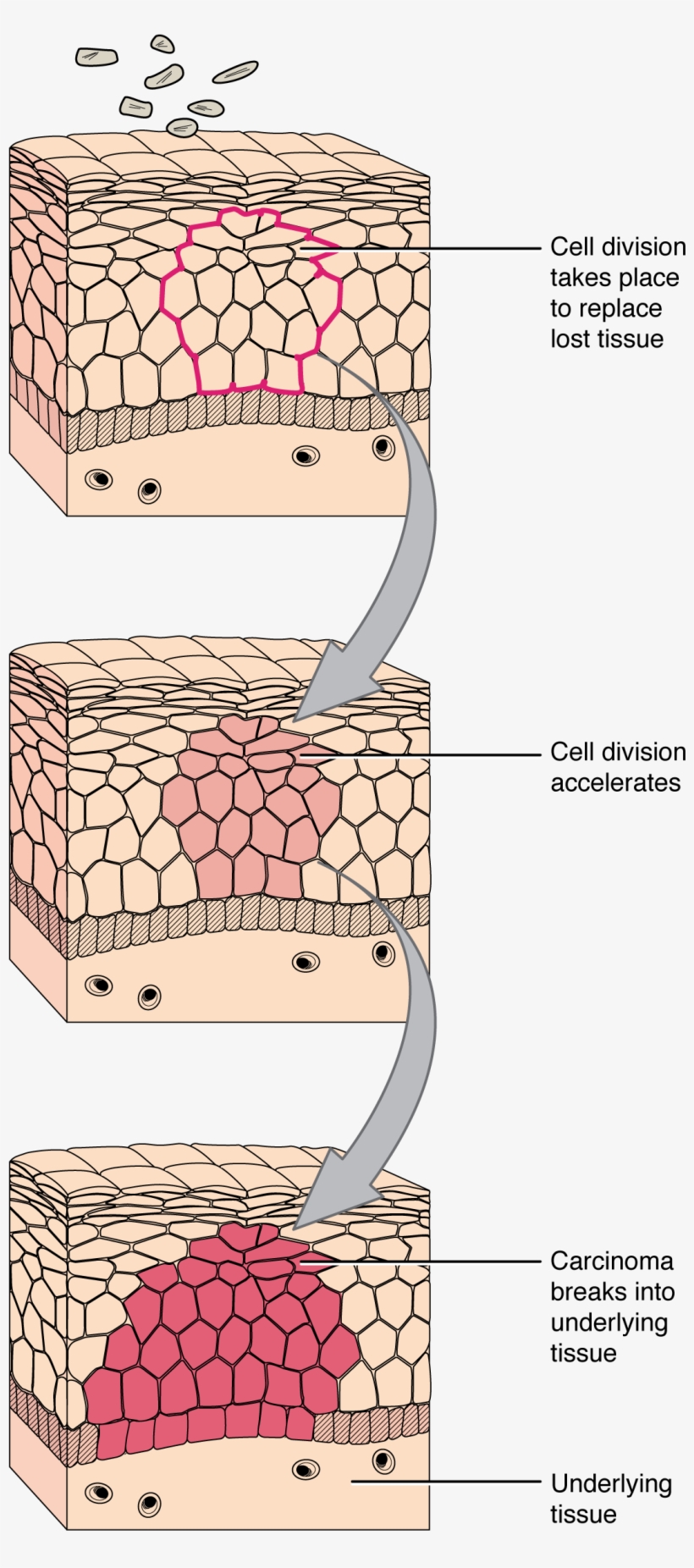 418 Development Of Cancer - Tissue Cell Diagram, transparent png