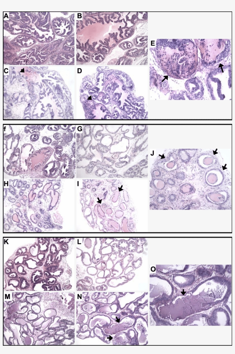 Comparison Of Prostate Lobe Ap , Dlp (f J), And Vp - Dihydrotestosterone, transparent png