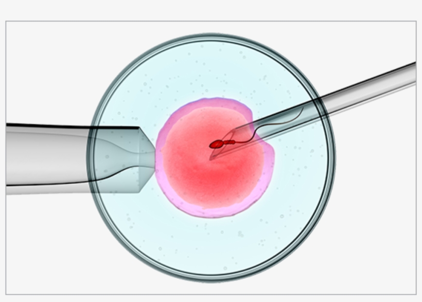 Deepam Fertility Centre Is Functioning As A Separate - Ivf, transparent png