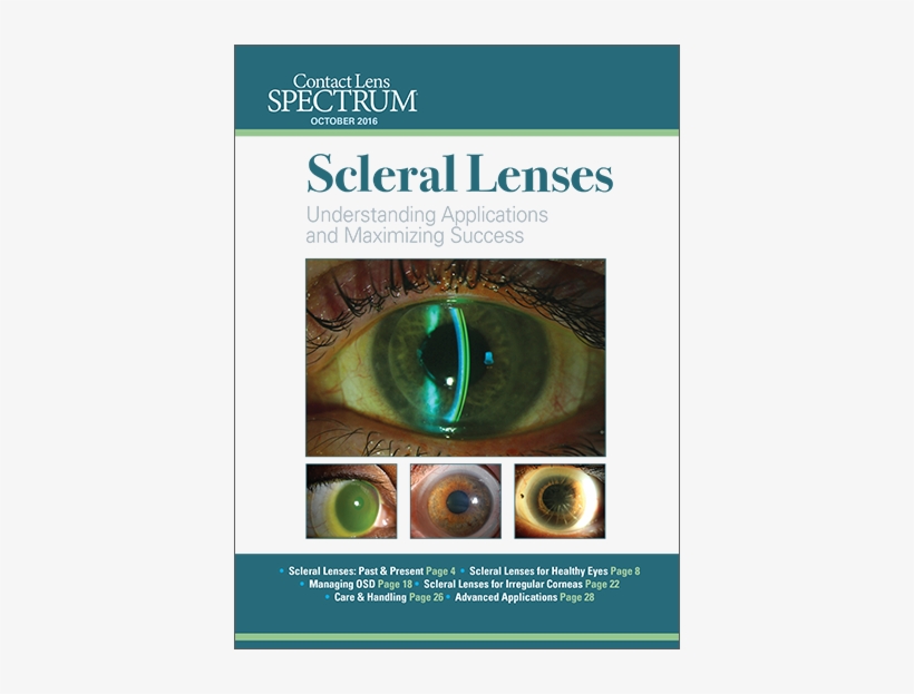 This Special Editorial Supplement Serves As An Introduction - Scleral Lens, transparent png