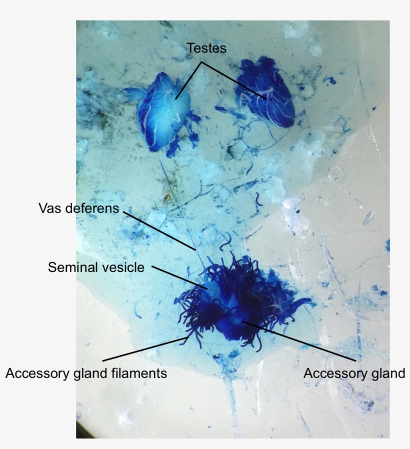 Female Cricket - - Male Reproductive System Of Locust, transparent png