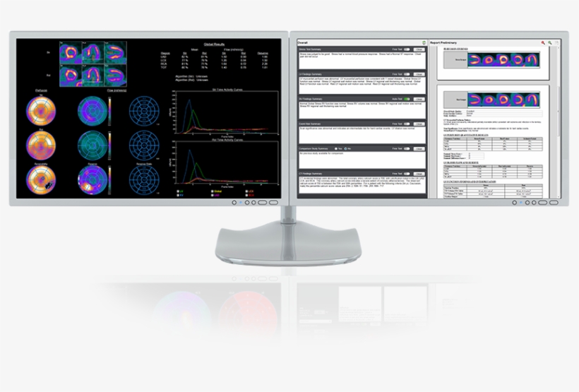 Invia Can Package 4dm To Fit Your Needs With Any Combination - Computer Monitor, transparent png