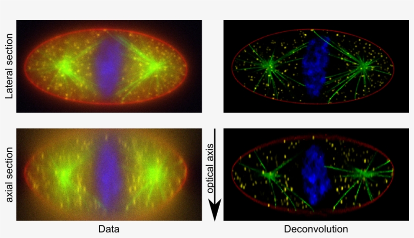 Http - //cral - Univ-lyon1 - Fr/labo/perso/ferreol - Deconvolution Fluorescence Microscopy, transparent png