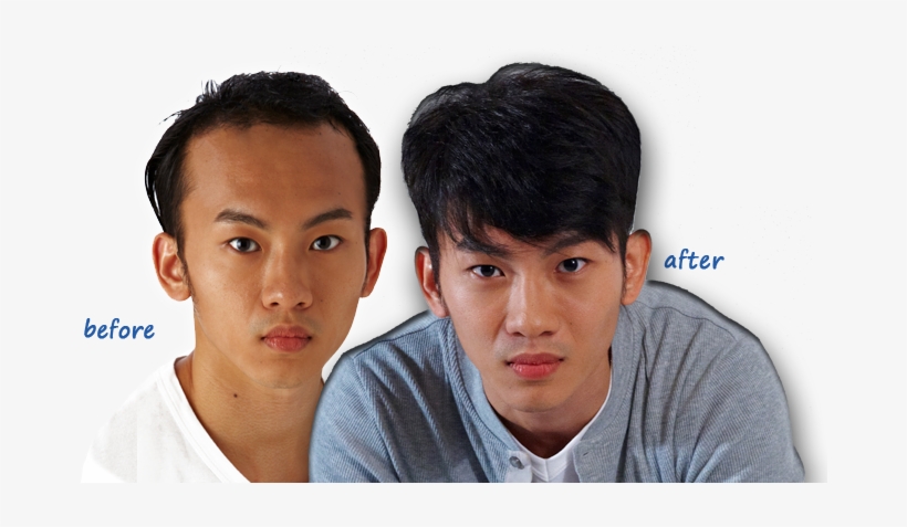 Aremy Hair Salon Is Very Customer Focus Both In Terms - Male Hair Loss Singapore, transparent png