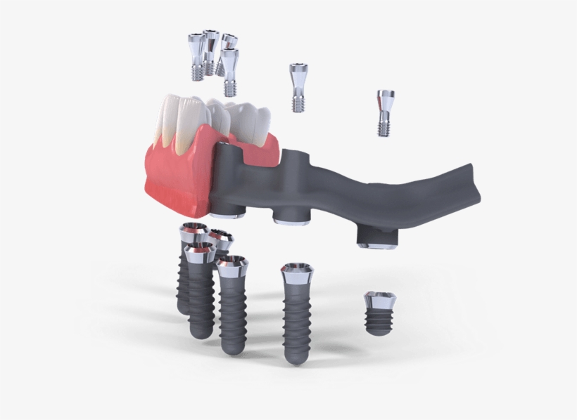 Straumann Pro Arch, transparent png