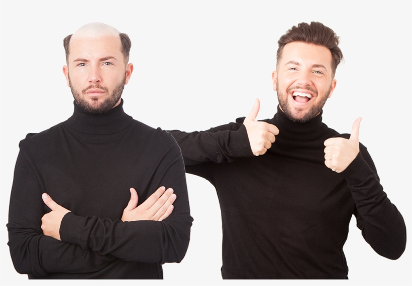 Discover The Most Natural, Modern And Stylish Non-surgical - Non Surgical Hair Replacement Glasgow, transparent png