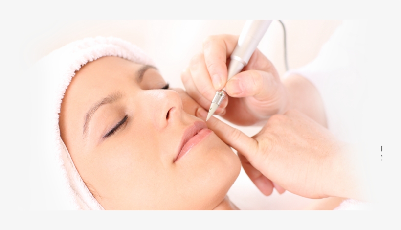 View Treatments - Electrolysis Remove White Hair, transparent png