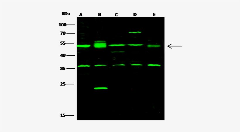 Mouse C-src Kinase / Csk Western Blot - Hsp60, transparent png