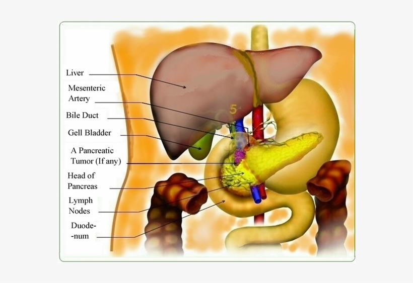 Location Of The Pancreatic Tumor - Pancreas In French, transparent png