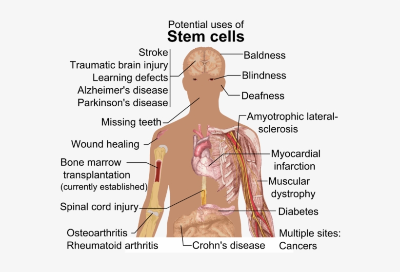 293 × 240 Píxeles - Can Stem Cells Cure, transparent png