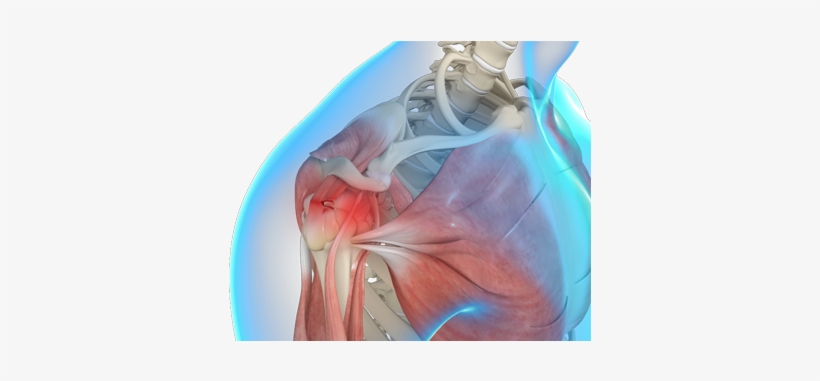 Rotator Cuff - Boise, transparent png