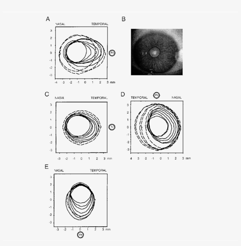 Pupil Dilation Following Focal Drug Application - Circle, transparent png