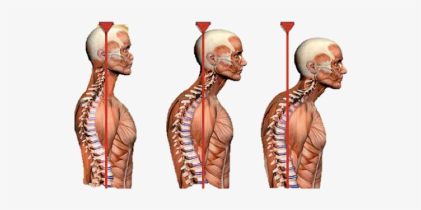 Having The Head Sitting More Forward Could Lead To - 24seven Wellness & Living Back Pain Relief Dvd, transparent png