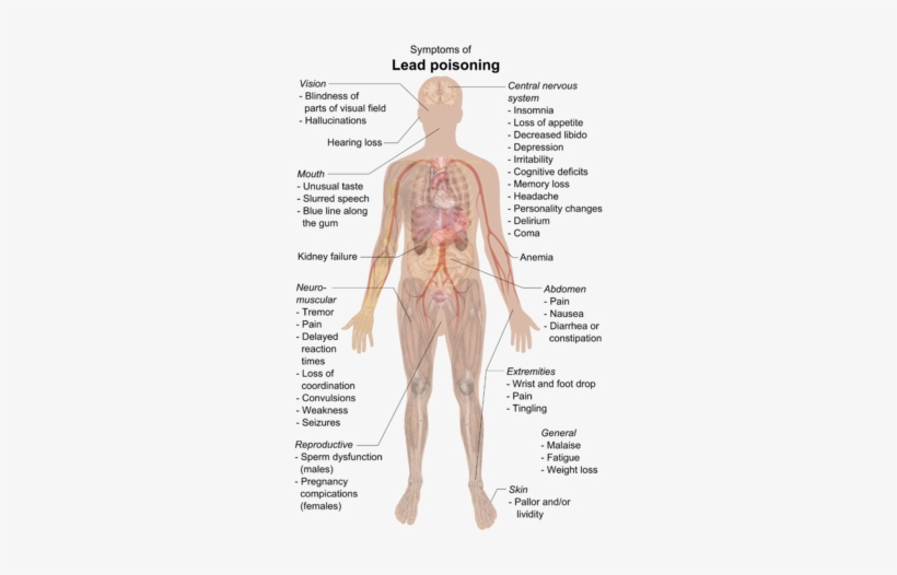 Who Discovered The Nervous System Best Of Lead Poisoning - Lead Poisoning Symptoms, transparent png