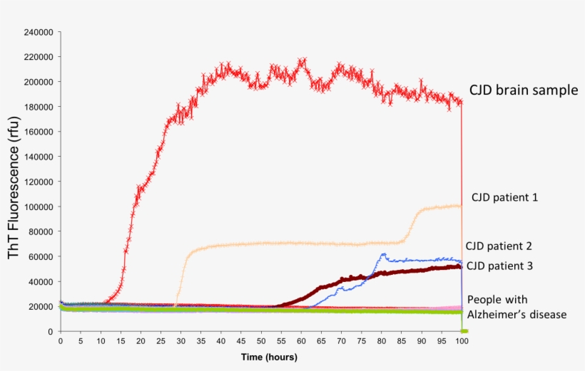 Tracking A Biomarker Over Time In Post-mortem Tissue, - Tissue, transparent png
