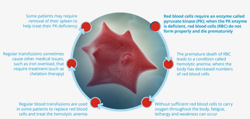 What Happens In Patients With Pk Deficiency - Star Cell Pyruvate Kinase Deficiency, transparent png