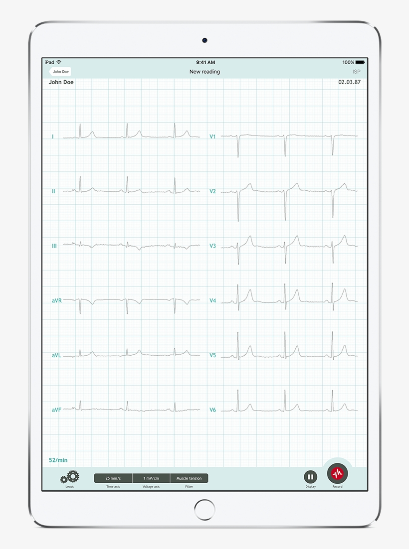 Cardiosecur Pro 12 Leads - Paper, transparent png