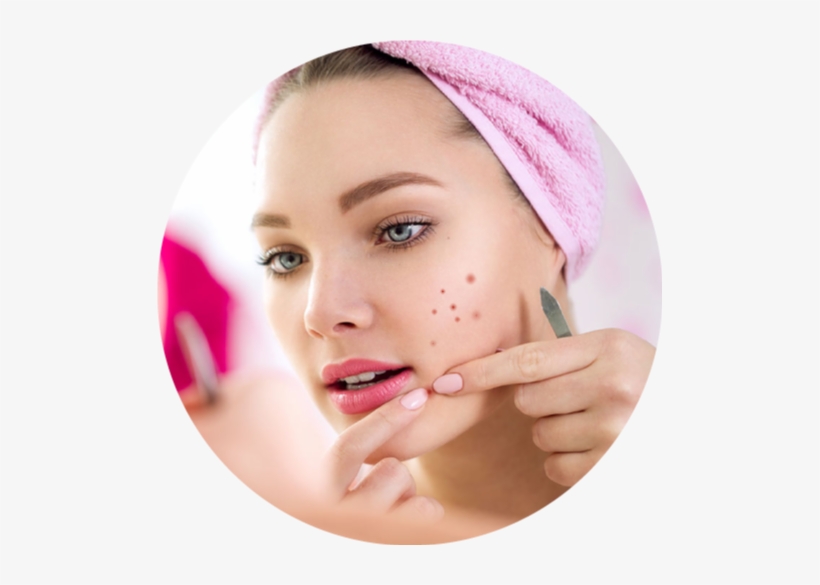 Brief Info On Pimples - Victoria's Body Shoppe Victorias Celebrity Advanced, transparent png