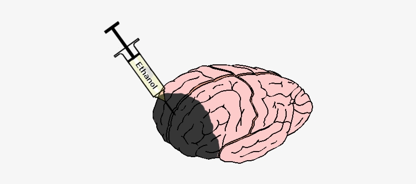 Symbolic Effect Of Brain Damaged By Too Much Alcohol - Brain And Alcohol Png, transparent png