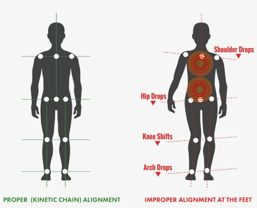 Back Pain - Illustration, transparent png