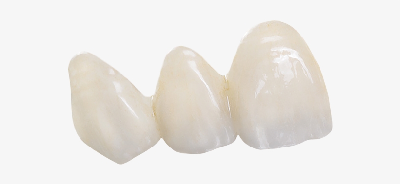 Bruxzir Anterior Teeth - Brassiere, transparent png