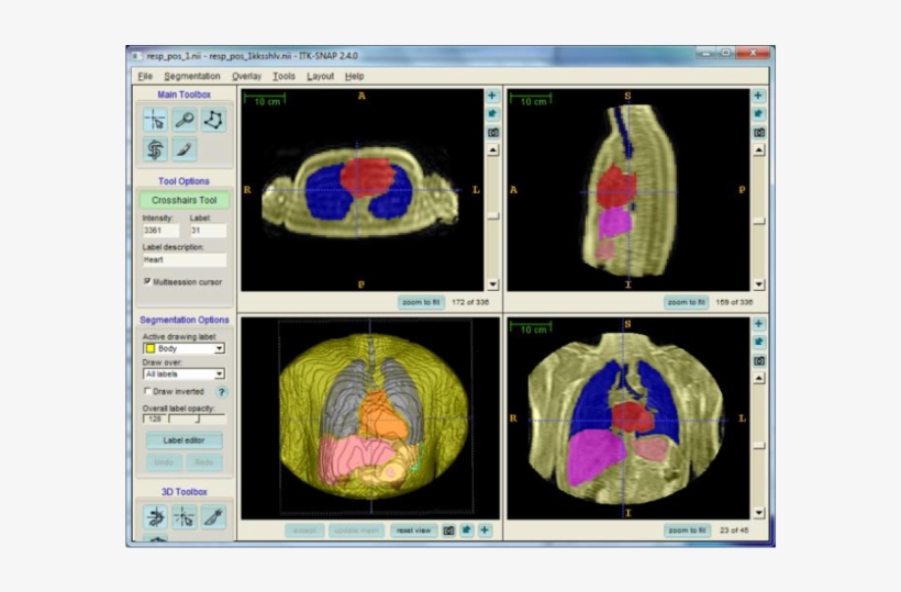 The Rendered Anatomy Are The Lungs , Heart (red), Liver - Rendering, transparent png