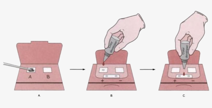 Fecal Occult Blood Test - Guaiac Test Steps, transparent png
