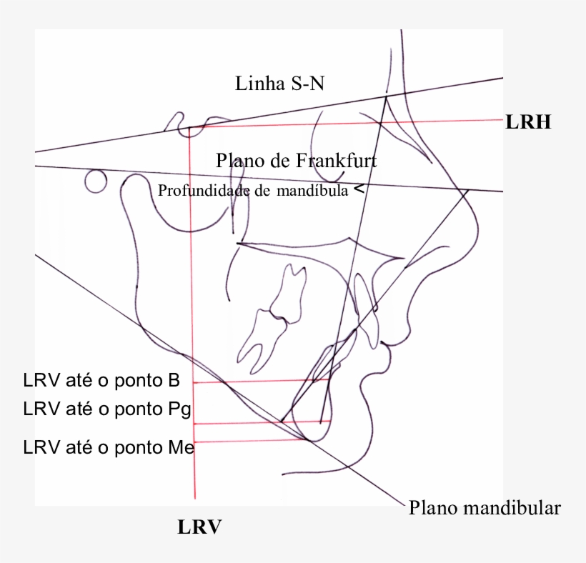 Linhas De Referência Vertical Lrv E Horizontal Lrh, - Diagram, transparent png