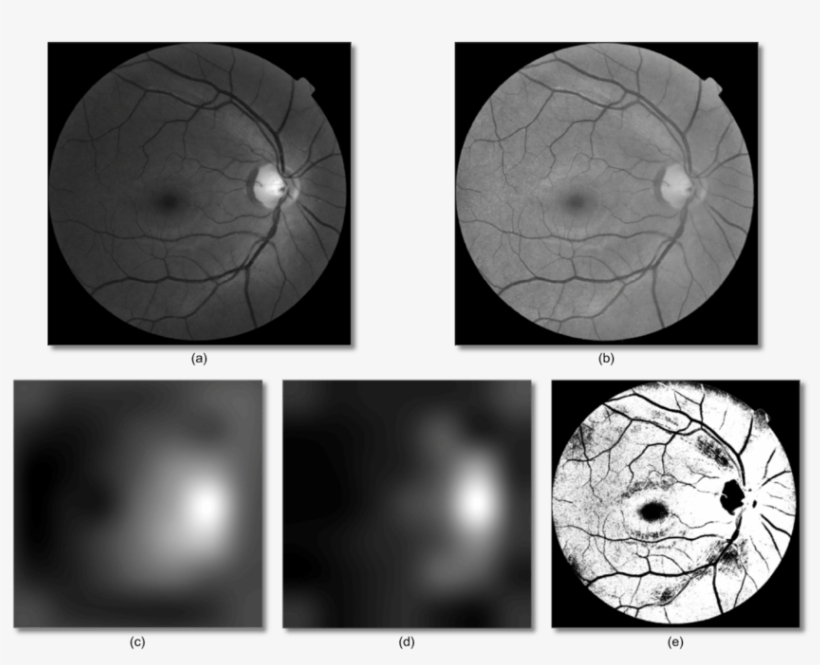 Background Removal By Foracchia Et Al - 2011, transparent png