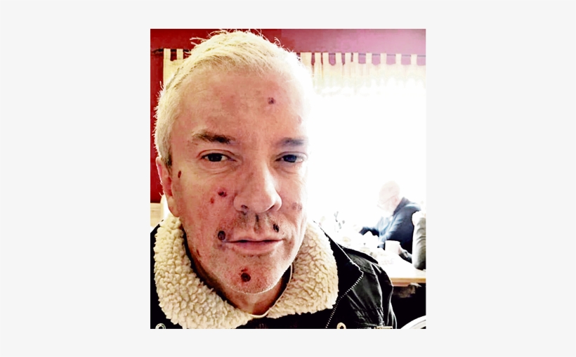 Telly Star Justin Ryan Reveals Shock Cancer Scare After - Colin Justin 60 Minute Makeover, transparent png