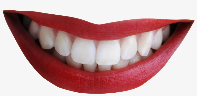 Smiling Lips Png - Cara Alami Buat Gigi Tidak Maju, transparent png