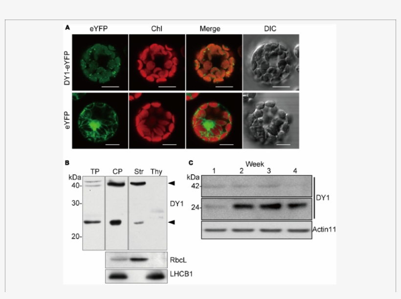 Dy1 Is A Chloroplast Stroma Protein - Stroma, transparent png