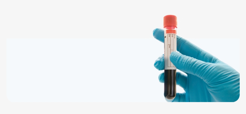 My Pet Is Having A Blood Test - Blood Sample Png, transparent png