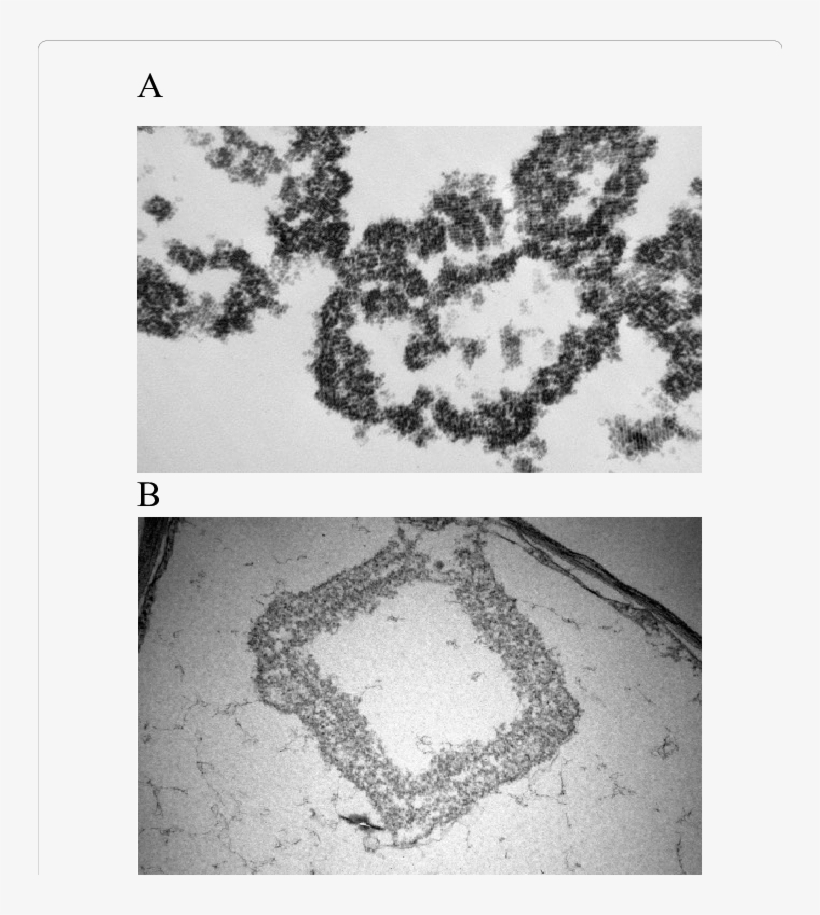A) Cmv Viral Nanoparticles Appears In Geometric Rows - Crystal, transparent png
