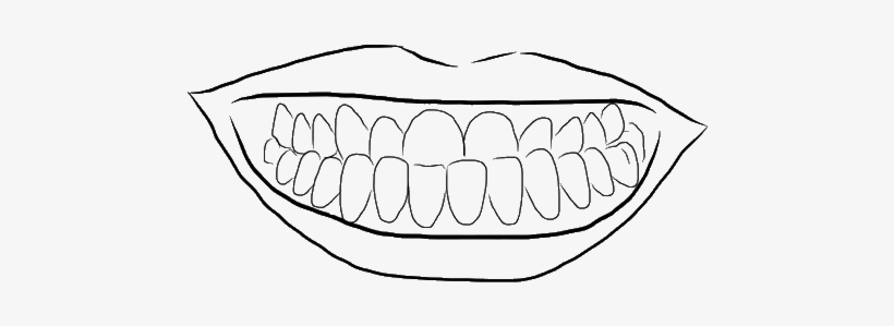 Underbite - Kevin B. Sands, Dds, transparent png
