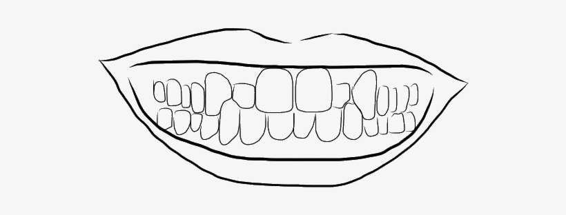Crossbite - Line Art, transparent png