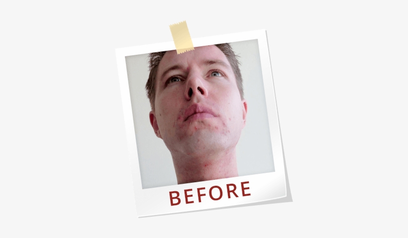 Paul Jaminet Ph - Logan Paul With Pimples, transparent png