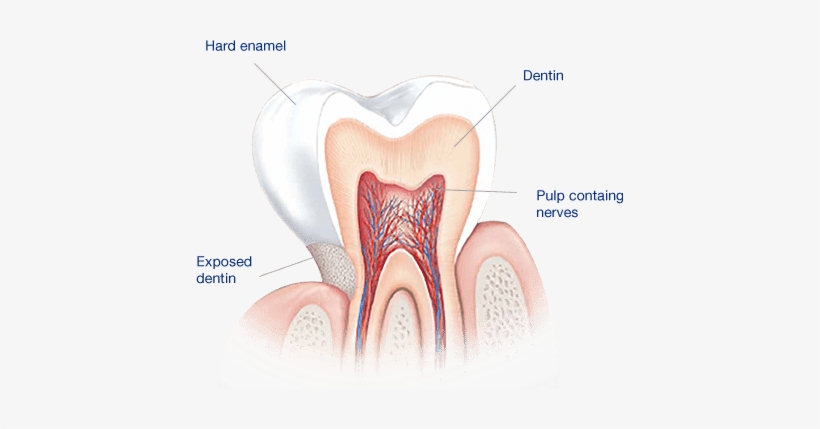 What Causes Sensitive Teeth - Dentes Sensiveis, transparent png